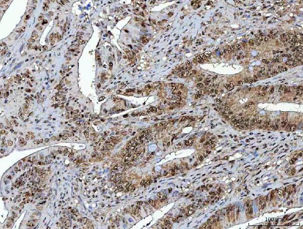  IHC analysis of NSUN2 using anti-NSUN2 antibody (A03878-1)