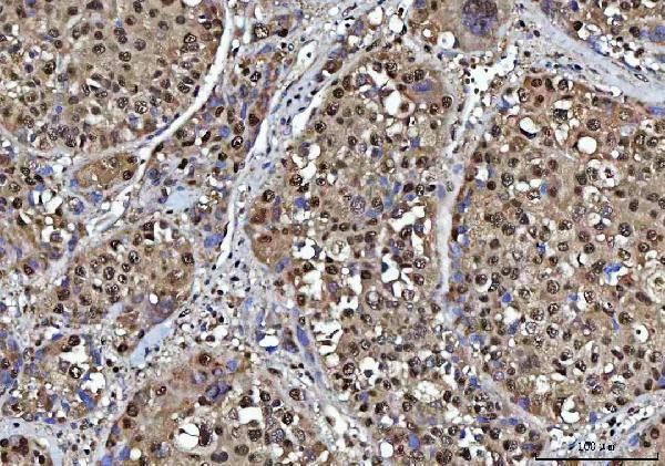 a03878 1 nsun2 primary antibodies ihc testing 4