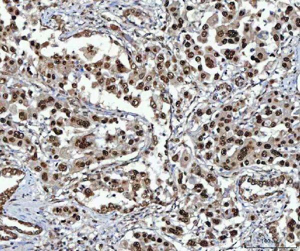 a03878 1 nsun2 primary antibodies ihc testing 5