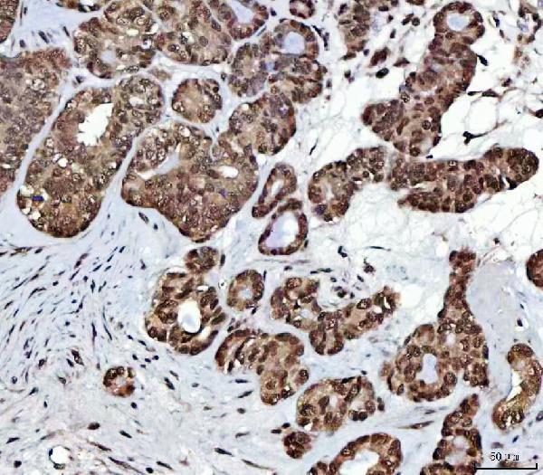 a03878 1 nsun2 primary antibodies ihc testing 6
