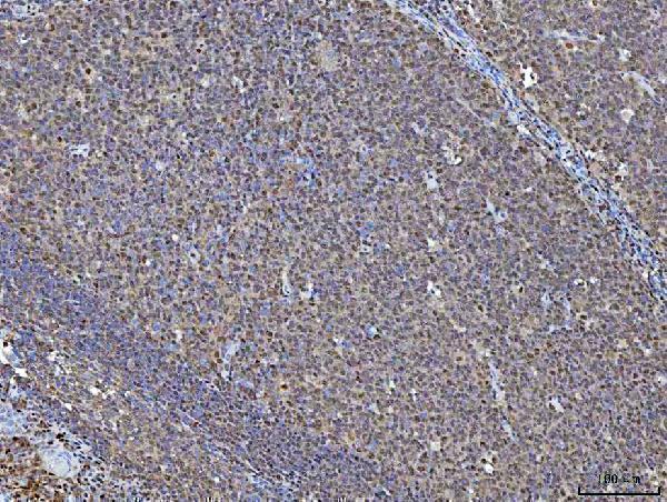 a03878 1 nsun2 primary antibodies ihc testing 7
