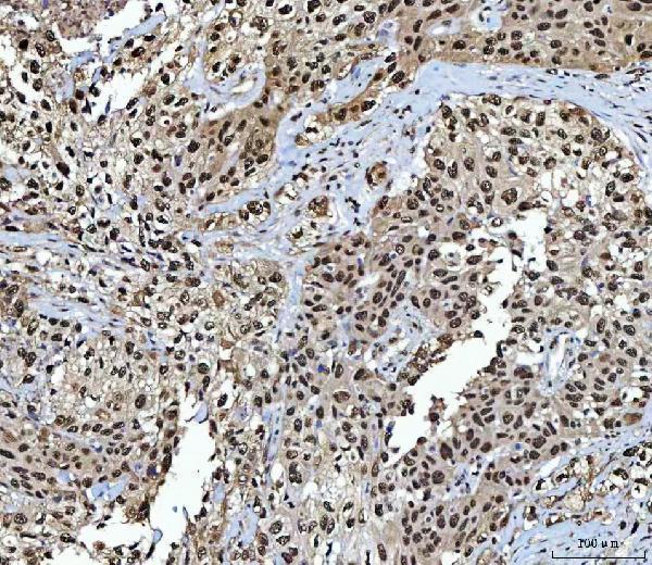 a03878 1 nsun2 primary antibodies ihc testing 8
