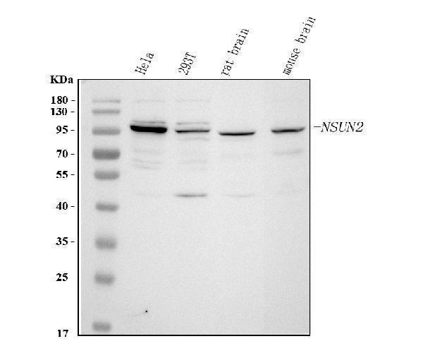  Western blot analysis of NSUN2 using anti-NSUN2 antibody (A03878-1)
