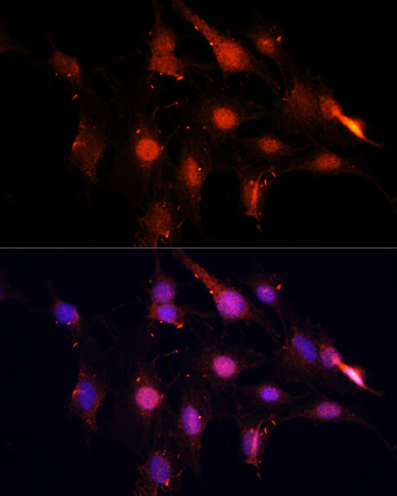 a03878 nsun2 primary antiboties if testing 3