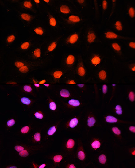 a03878 nsun2 primary antiboties if testing 4