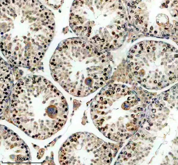 a03882 3 prdm9 primary antibodies ihc testing 1