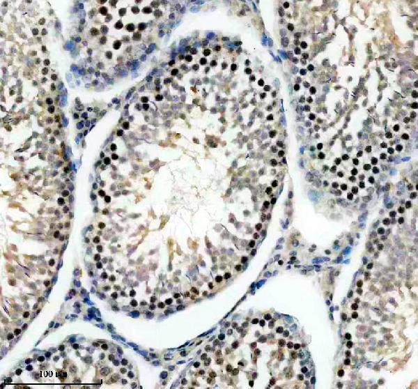a03882 3 prdm9 primary antibodies ihc testing 2
