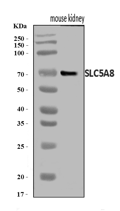  Western blot analysis of SLC5A8 using anti-SLC5A8 antibody (A03883-3)