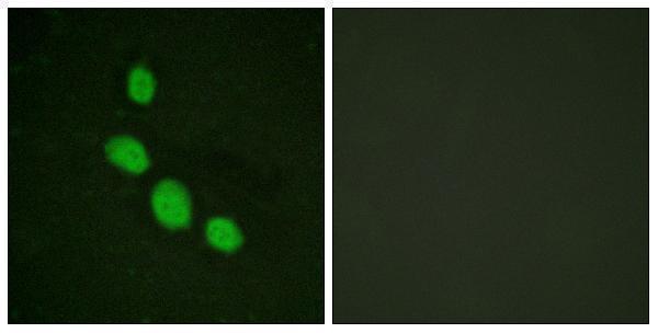 a03884 1 cebpe primary antibodies if testing 1