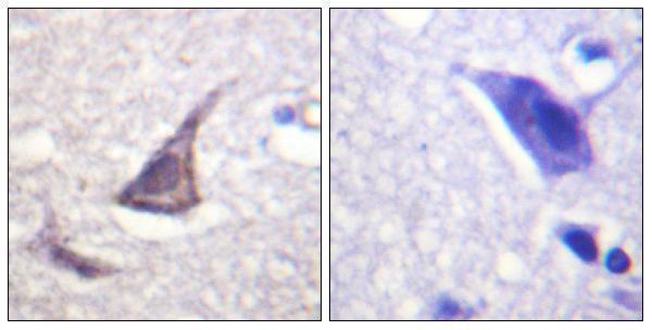 Immunohistochemistry analysis of paraffin-embedded human brain tissue, using C/EBP-epsilon Antibody
