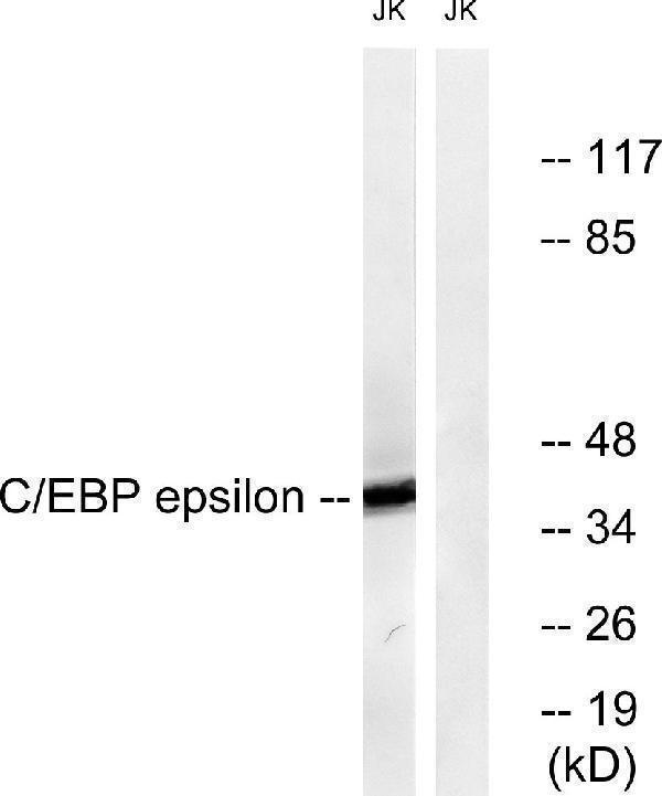 Western blot analysis of lysates from JurKat cells, treated with Insulin 0