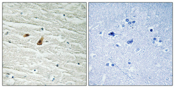 Immunohistochemistry validation of CEBPE using Anti-Phospho-C/EBP epsilon (T74) CEBPE Antibody (A03884T74)