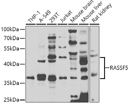 a03885 1 rassf5 primary antiboties wb testing 1