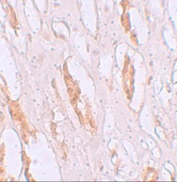 Immunohistochemistry of ZIP1 in human kidney tissue with ZIP1 antibody at 2