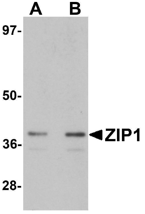 Western blot analysis of ZIP1 in mouse kidney tissue lysate with ZIP1 antibody at (A) 1 and (B) 2 μg/mL