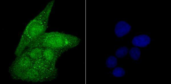 ICC staining USP22 in Hela cells (green)