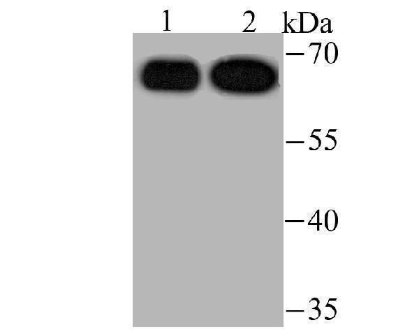 Western blot analysis of USP22 on Hela (1) and HepG2 (2) cell lysate using anti-USP22 antibody at 1/500 dilution