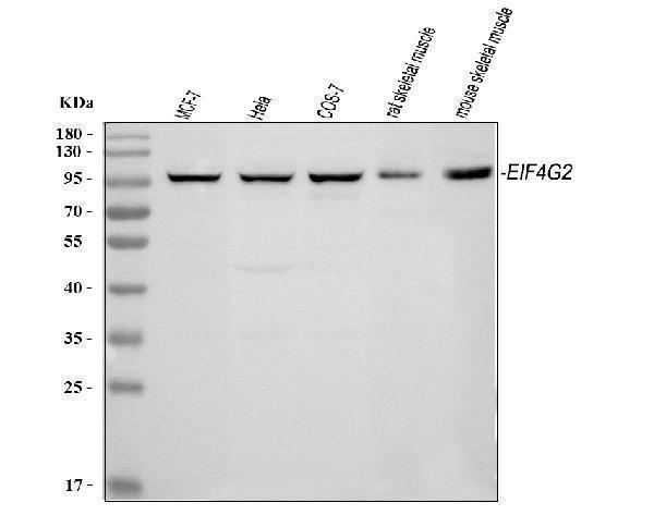  Western blot analysis of P97/DAP5/EIF4G2 using anti-P97/DAP5/EIF4G2 antibody (A03888-1)
