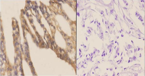 a03888 eif4g2 primary antiboties ihc testing 2