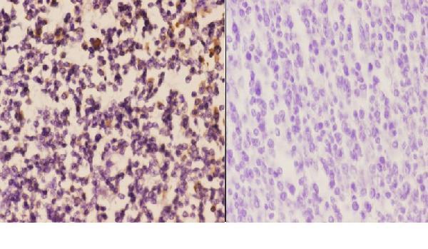 a03888 eif4g2 primary antiboties ihc testing 3