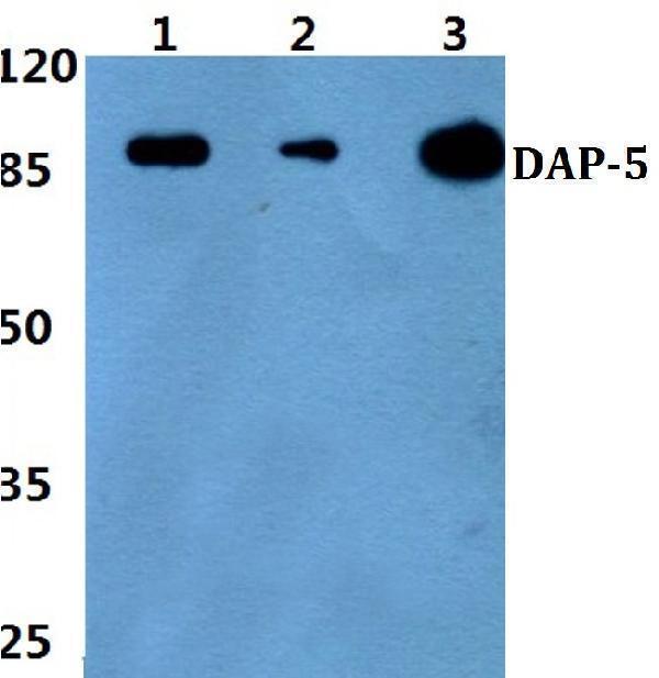 a03888 eif4g2 primary antiboties wb testing 1