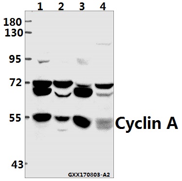 a03889 3 ccna1 primary antiboties wb testing 1