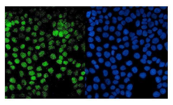  IF analysis of PTF1A using anti-PTF1A antibody (A03891-2)