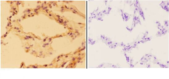 a03893 1 aldob primary antiboties ihc testing 2