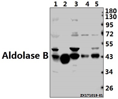a03893 1 aldob primary antiboties wb testing 1