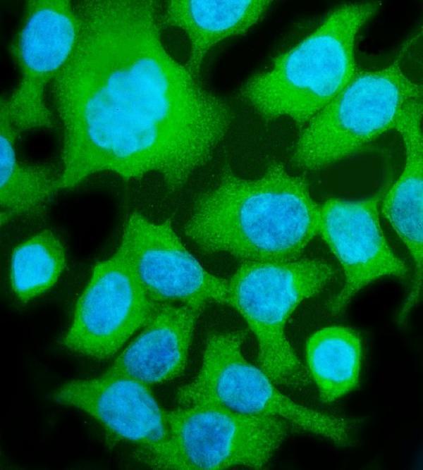 a03893 2 aldob primary antibodies if testing 6