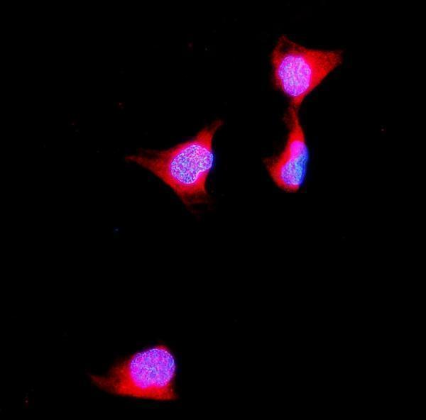 a03893 2 aldob primary antibodies if testing 7