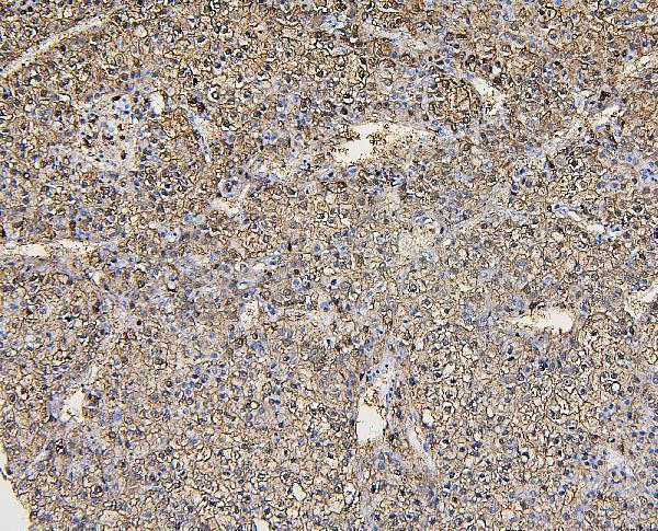 a03893 2 aldob primary antibodies ihc testing 2