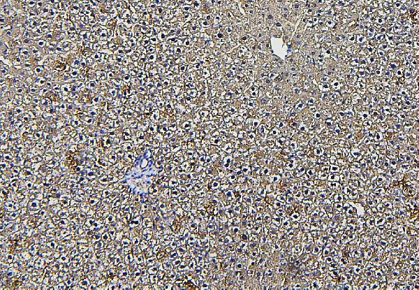 a03893 2 aldob primary antibodies ihc testing 3