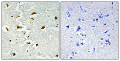 a03893 aldob primary antibodies ihc testing 1