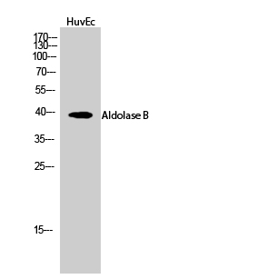 a03893 aldob primary antibodies wb testing 2