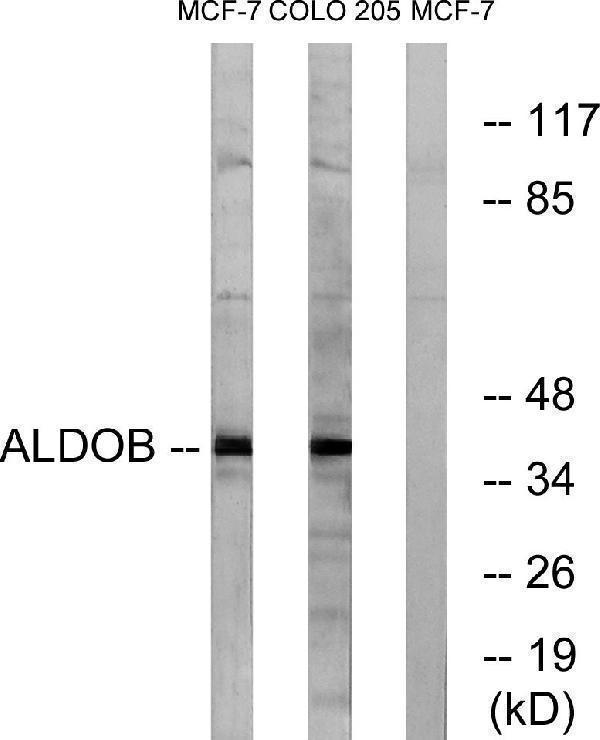 a03893 aldob primary antibodies wb testing 3