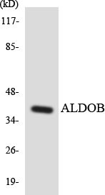 a03893 aldob primary antibodies wb testing 4