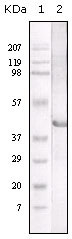 Western Blot analysis using LAL Monoclonal Antibody against LAL recombinant protein