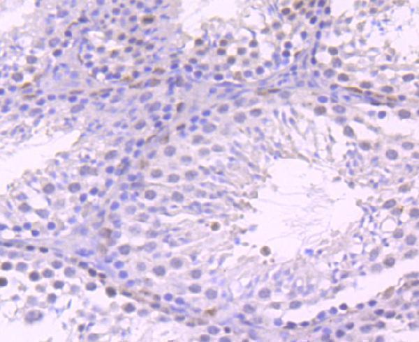 a03896 1 kat7 primary antiboties ihc testing 1
