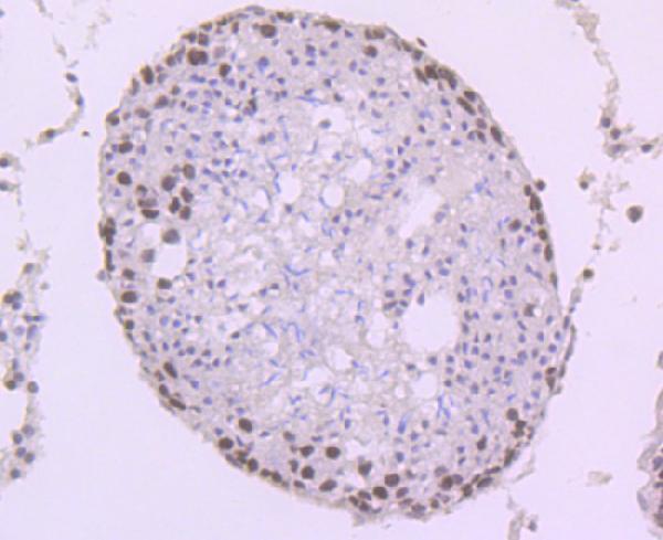 a03896 1 kat7 primary antiboties ihc testing 2