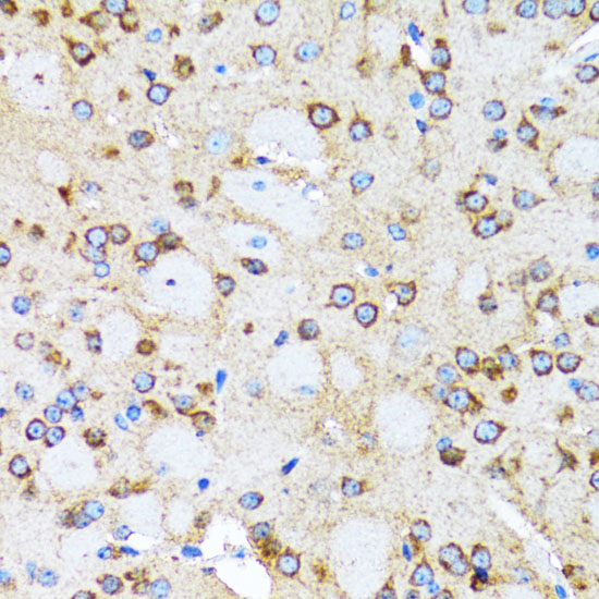 a03898 actr2 primary antiboties ihc testing 2