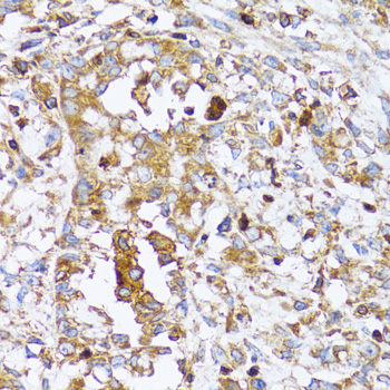 a03898 actr2 primary antiboties ihc testing 3