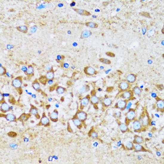 a03898 actr2 primary antiboties ihc testing 4