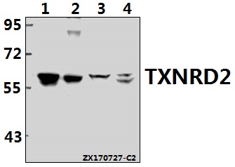 Western blot (WB) analysis of TXNRD2 (S501) pAb at 1:500 dilution
Lane1:K562 whole cell lysate(40ug)
Lane2:HEK293T whole cell lysate(40ug)
Lane3:C6 whole cell lysate(40ug)
Lane4:CT26 whole cell lysate(40ug)