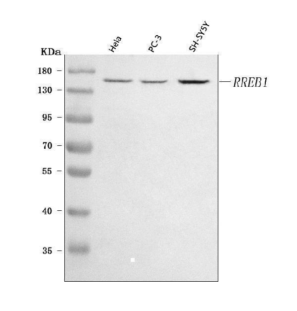  Western blot analysis of RREB1 using anti-RREB1 antibody (A03902-2)