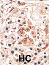 a03907 anti hippocalcin antibody n term ihc p testing 2