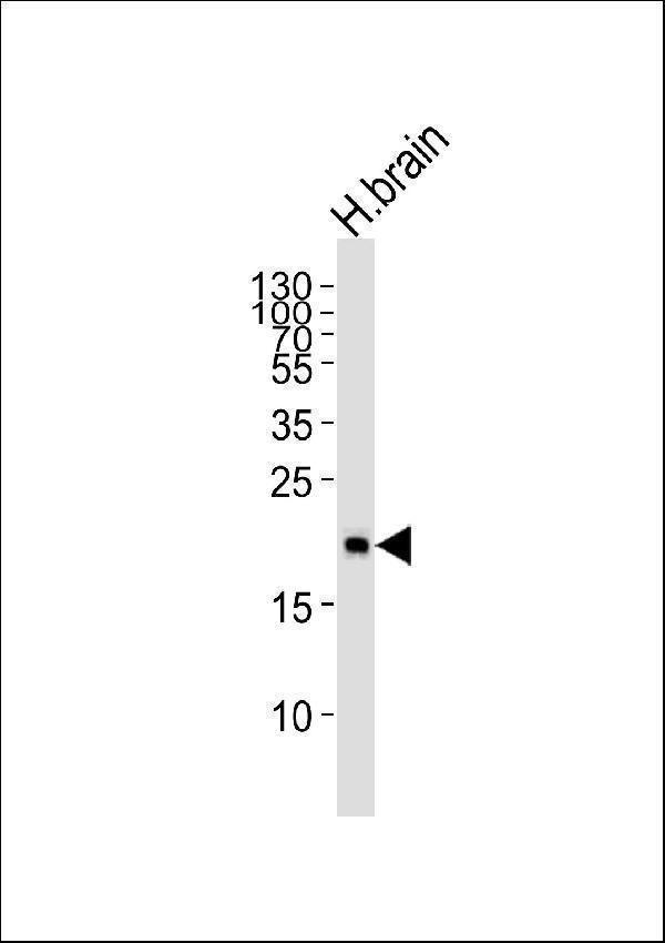 a03907 anti hippocalcin antibody n term wb testing 1