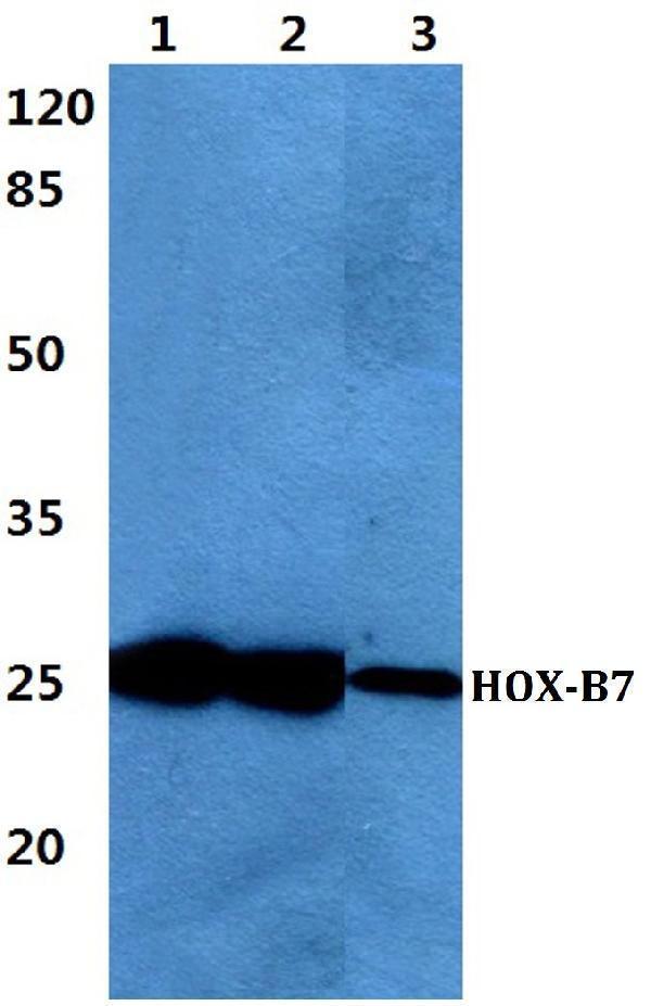 Western blot (WB) analysis of HOX-B7 polyclonal antibody at 1:500 dilution
Lane1:Hela cell lysate
Lane2:Raw264