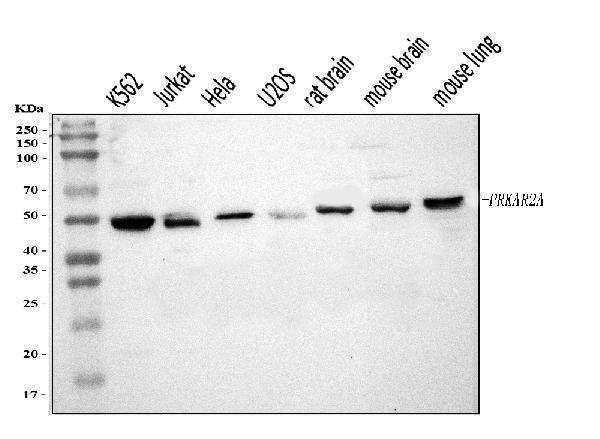  Western blot analysis of PKA R2/PKR2/PRKAR2A using anti-PKA R2/PKR2/PRKAR2A antibody (A03911-2)