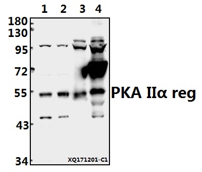 Western blot (WB) analysis of PKA IIα reg (P68) pAb at 1:500 dilution
Lane1:PC3 whole cell lysate(10ug)
Lane2:U-87MG whole cell lysate(10ug)
Lane3:The Uterus tissue lysate of Rat(40ug)
Lane4:AML-12 whole cell lysate(40ug)